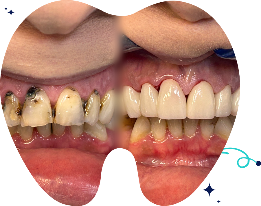 before-after-image https://www.boroniaheightsfamilydental.com.au/wp-content/uploads/2025/06/before-after-image.png